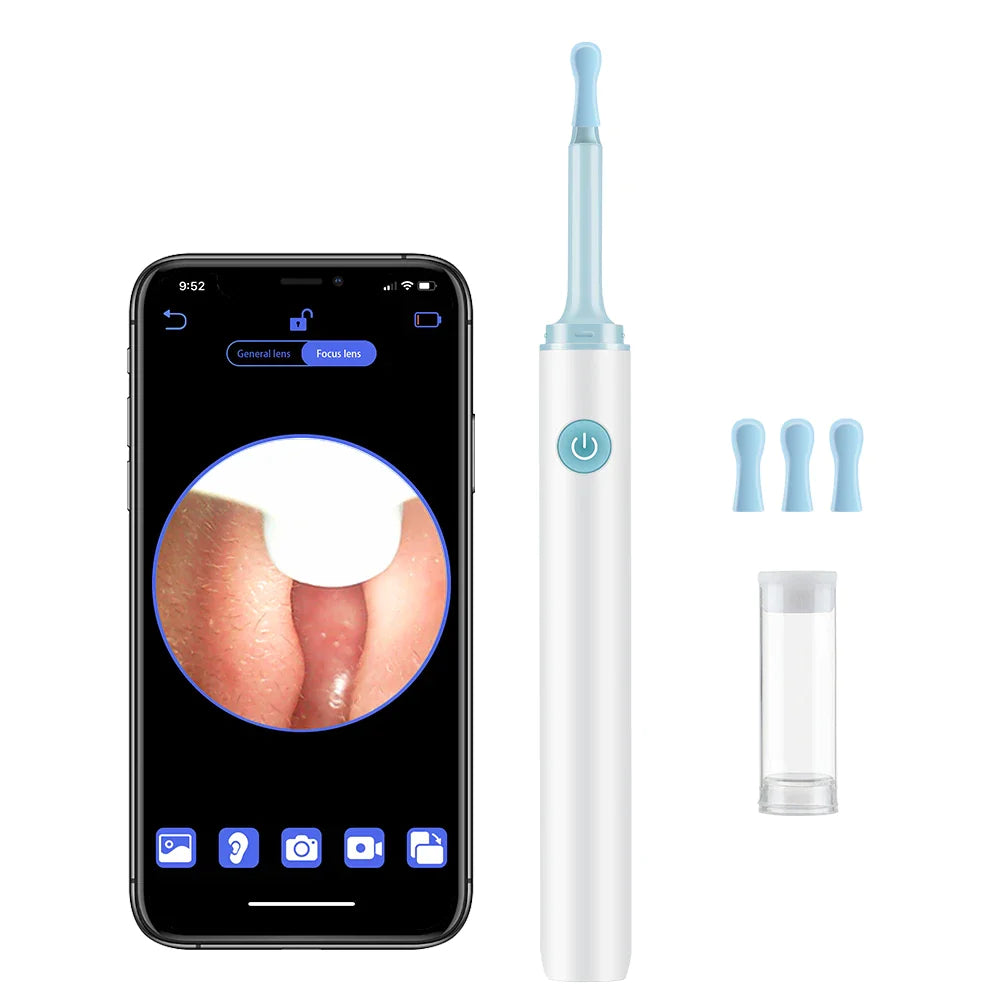 ClearSound™ Ear Wax Remover (70% OFF)